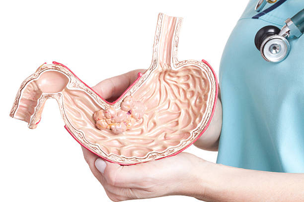 surgeon for stomach cancer Best Surgeon For Stomach Cancer In Sion, Mumbai